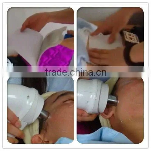 Professional 532nm, 1064nm ND Yag Laser hair removal, tattoo removal Multifunction Beauty Equipment