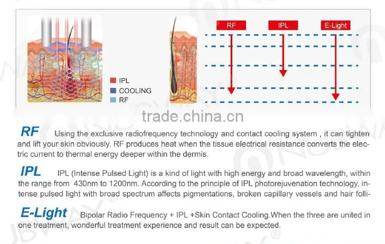 Laser hair removal fda approved ipl laser machine