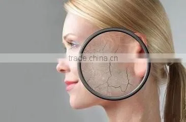 Newest oxygen skin rejuvenation ,pores removal and tightening skin machine for salon and clinic