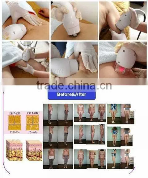 (CE ISO TUV SGS approved) 2014 best rf cavitation body slimming machine