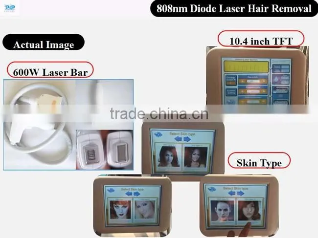 DLP7 808 diode Laser hair removal machine diode POP- DL7 808nm diode laser machine for POPIPL