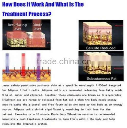 multifunctional lipolaser cavitation rf beauty machine / laser rf skin treatment machine