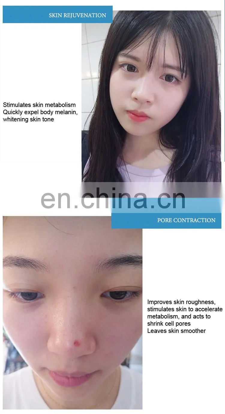 Germany Seyo TDA No Needle Mesotherapy Skin Rejuvenation Machine