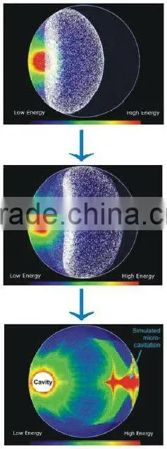 HIFU Tripolar RF