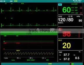 F5 Multi-parameter Monitor