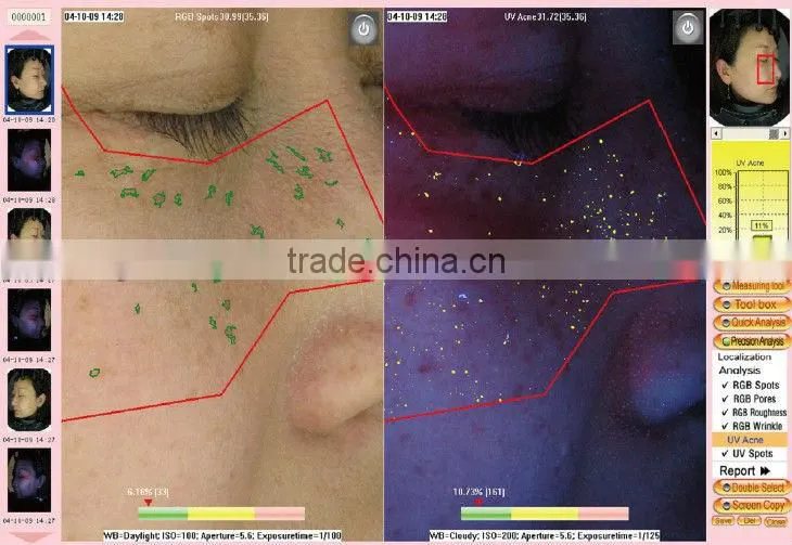 whole face testing skin analyzer magic mirror