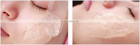 Newest portable e-light ipl