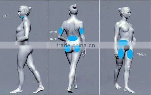 China leading high-tech fat cells removal 2 handles cryolipolysis machine weight loss