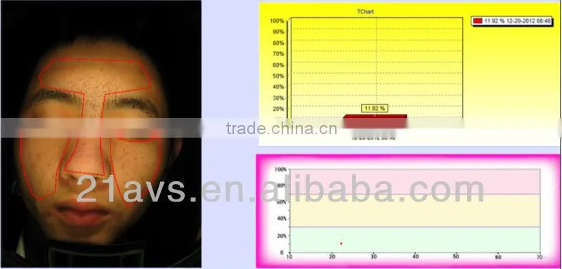 Guangzhou facial skin analysis machine