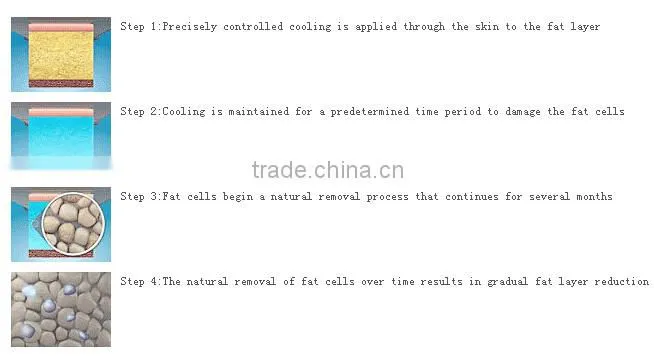 Fat freeze slimming!!!! cryo cellulit reduct cryolipolysi slim cryolipolysis machine