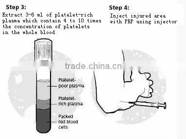 10ML ACD-APRP tube