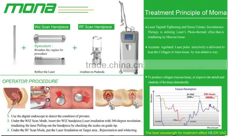 hot sale Factory direct SC-2 laser tube co2/acne removal laser tube co2/co2 vaginal rejuvenation