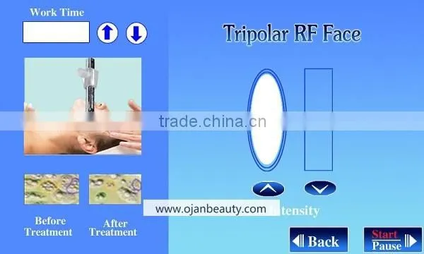 Best cavitation facial slimming weight loss beauty ultrasound machine for home use