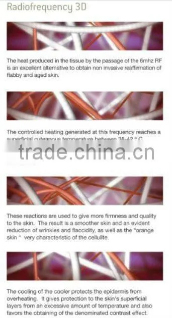 10Mhz RF Cavitation LipocoonX6 Weight loss Machine