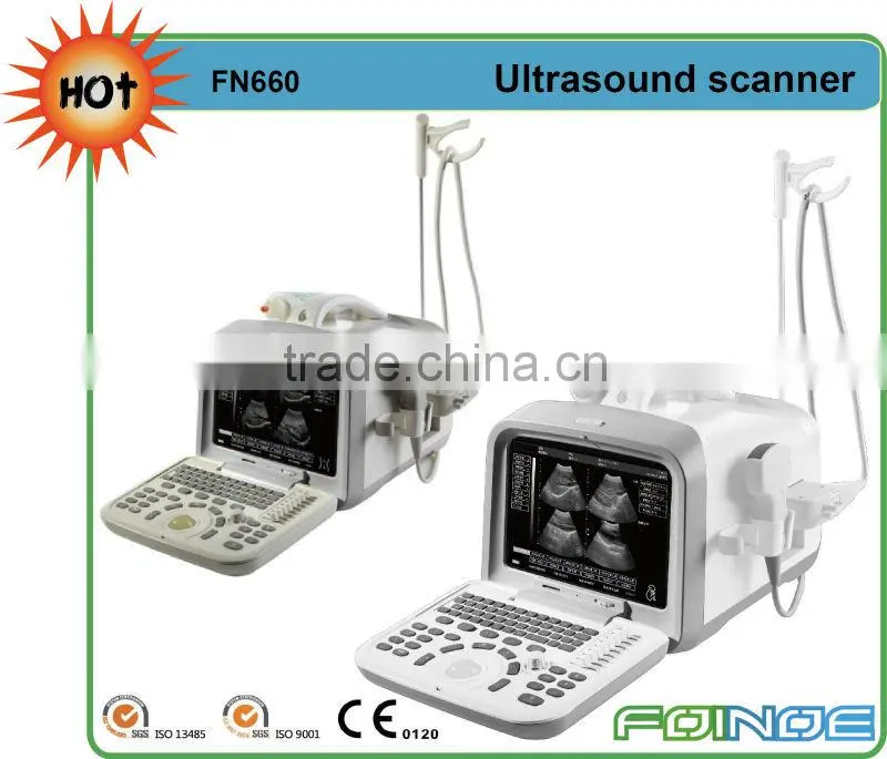 FN660 CE approved digital ultrasonic diagnostic imaging system