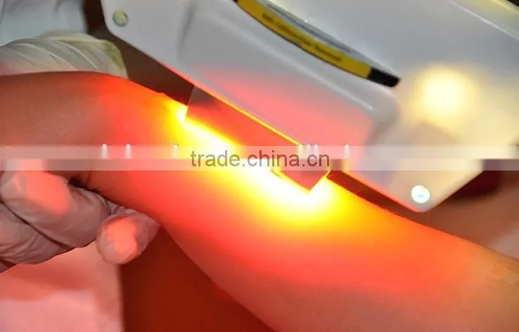 apollo ipl machine