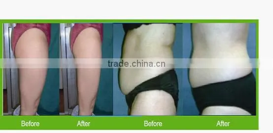 modern salon equipment cavitation body slimmer