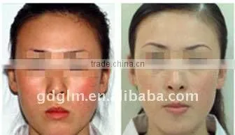 ipl portable beauty equipment with CE