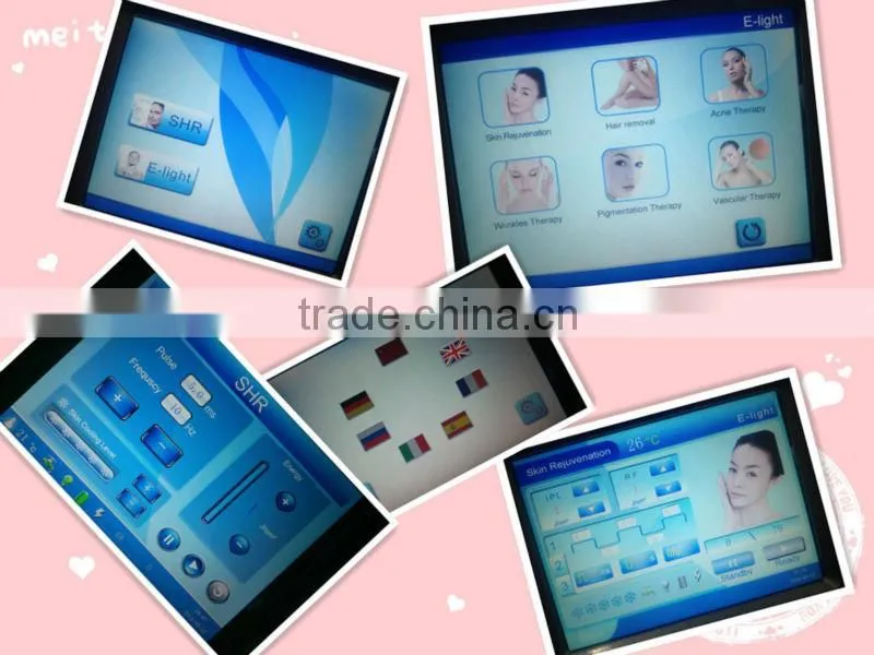 Hot selling!! AFT shr ipl acne treatment equipment/shr ipl rf elight/opt laser