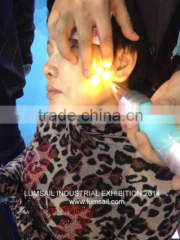IPL rf nd yag laser hair removal machine / Q switch mini nd yag laser machine