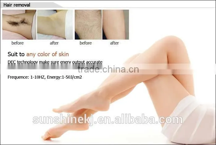 Big discount imported lamp two handles 3000w 1-10hz shr hair removal weifang ipl
