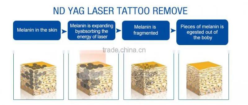 Hot Promotion! Electric Permanent Painless Lazer IPL Hair Removal Machine Cheap IPL