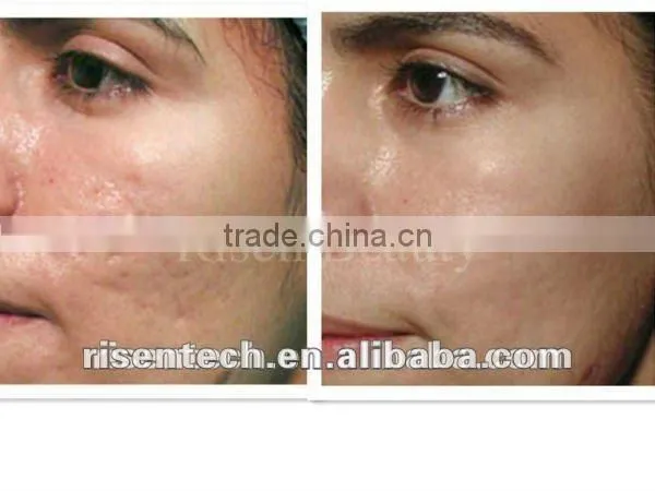 red green blue LED light therapy skin care beauty equipment LED mask