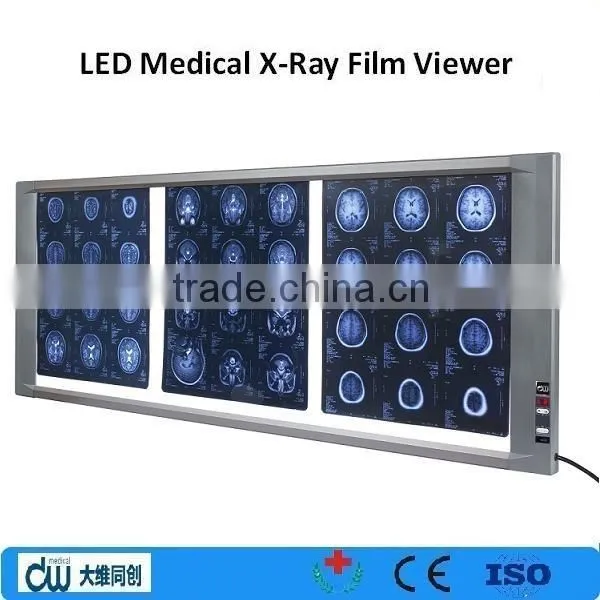medical LED adjustable film viewer / x ray machine/ negatoscope