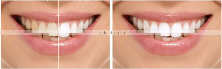 AYJ-J003A LED white light tooth whitening Machine