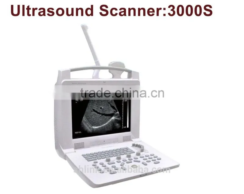 Medical Portable Ultrasonic Diagnostic System/Ultrasound scanner 3000S