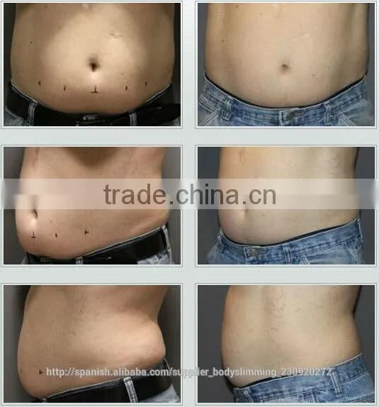 2014 latest home lipo laser weight loss machine (LM-HL600)