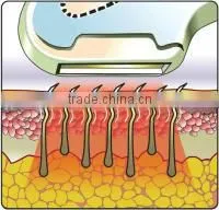 Pigment Removal IPL RF IPL Depilator