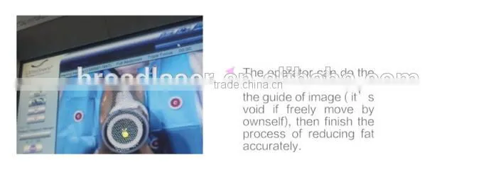 ultrashape body shaping slimming beauty aesthetic equipment