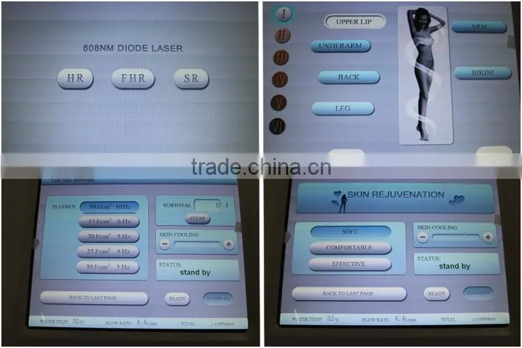 professional painless 808nm diode laser in hair removal