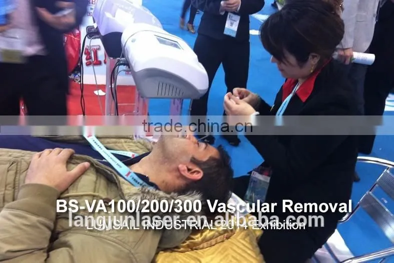 Spider Vein Removal/Vascular Removal