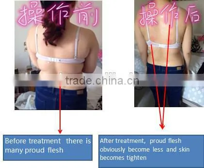 home use 6 in 1 ultrasound cavitation vacuum rf liposuction simming machine for sale
