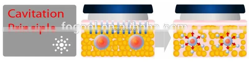 Ultrasonic Cavitation/Cavitation Slimming Machine/Cavitation Machine