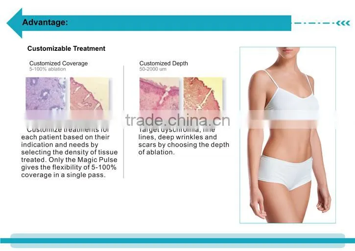 Good effect CO2 fractional laser skin spot removal wrinkle removal vaginal care machine--CV-I