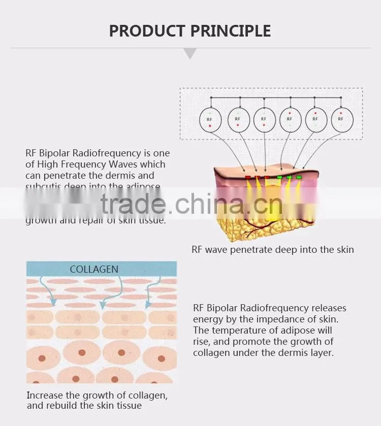 rf cavitation machine for smoother and tighter skin texture