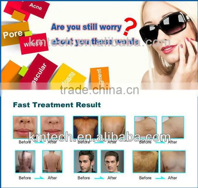 big discount super ipl with genermay ipl xenon flash lamp shot 100000 times