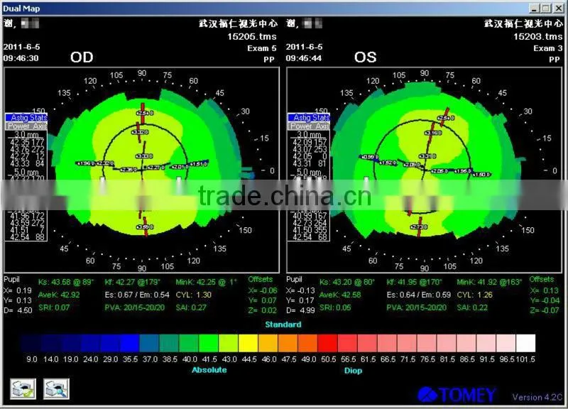 High-technology Mild MCT ,fpr myopia and amblyopia China