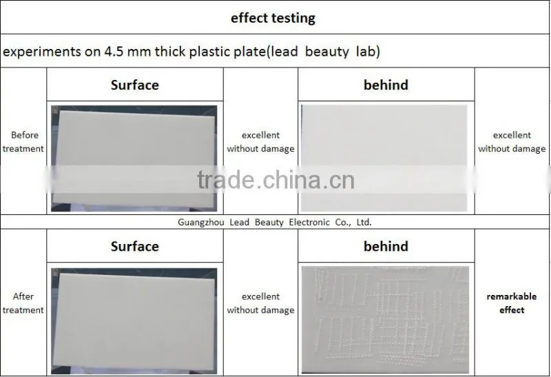 patent hifu /Korea double generation hifu/second generation hifu machine