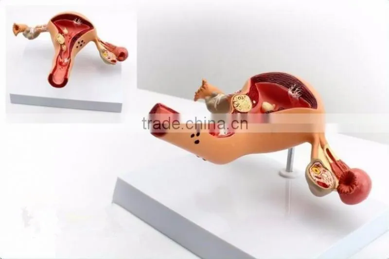 Human uterus and ovary vaginal pathological changes model of reproductive Department of gynecology medical demonstration model