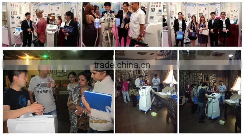Fractional rf microneedle scar removal/fractional rf microneedle stretch marks removal/fractional rf microneedle wrinkle removal