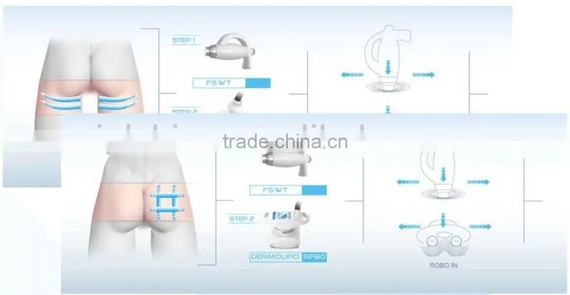 Beauty Equipment Supplier RSWT & FSWT RF Roller Vacuum Slimming Device