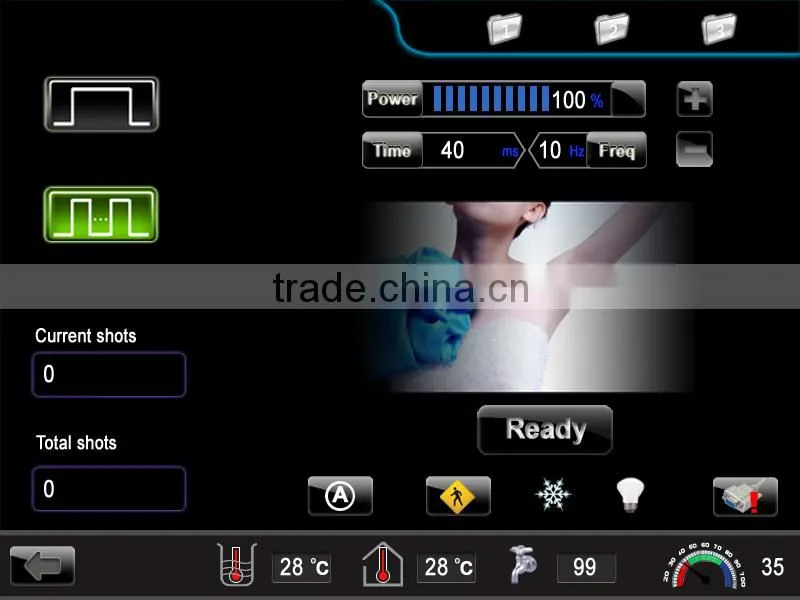 2014 Newest portable diode laser hair removal machine with Germany laser bar