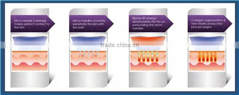 Hot selling oem skin whitening auto micro needl therapi system
