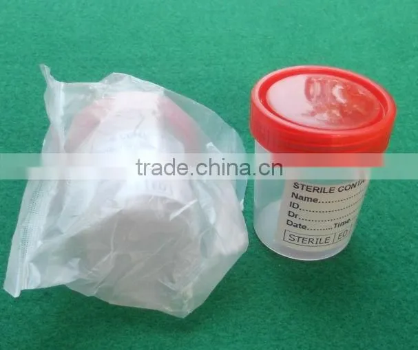 Urine cup