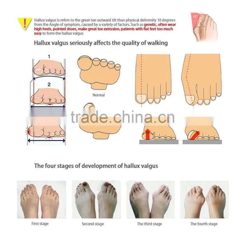 Soft Silica gel bunion protector Hallux valgus orthotics fit right/left toe