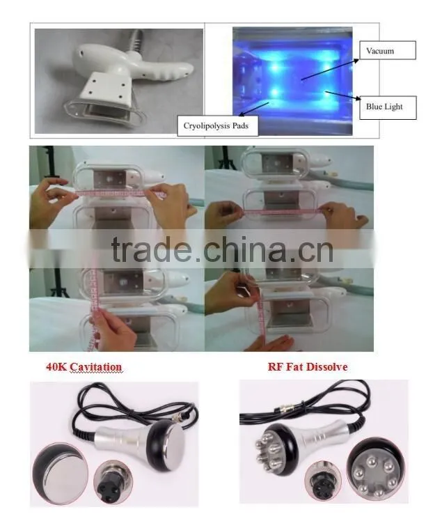 Hottest Professional Cool Body Sculpting Machine With Cavitaion & Multipolar RF